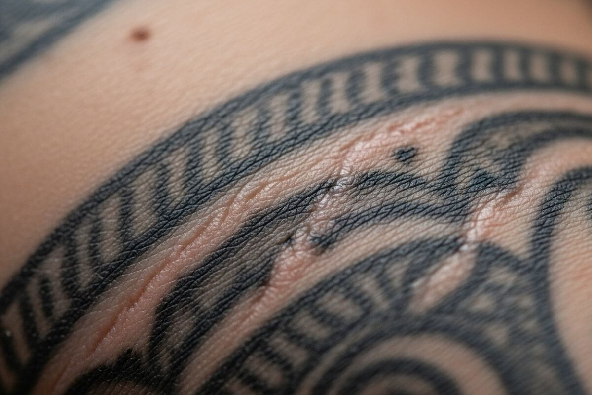tatto scarring on tattoo. How to reduce it